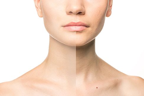 Клиника Beauty Alliance South в Краснодаре предлагает ультрасовременные безопасные методы поддержания и продления молодости кожи (лазерная биоревитализация), а стоимость процедур приемлема.